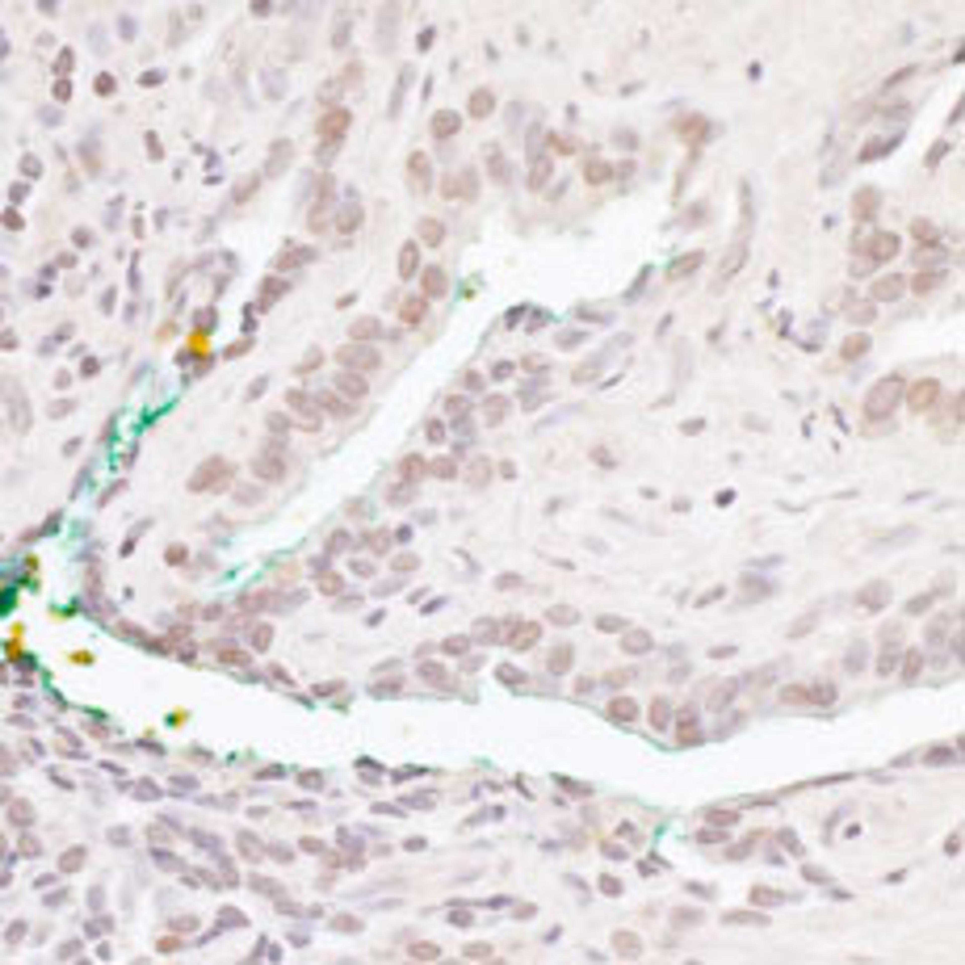 Detection of human Bcl11b by immunohistochemistry.