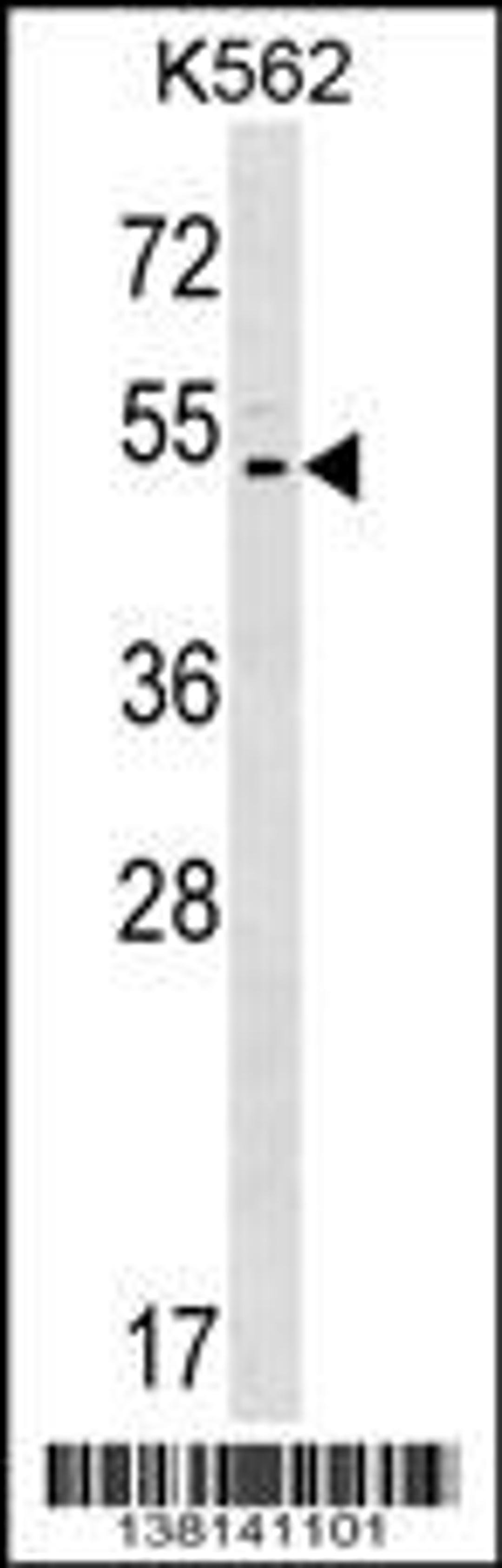 Western blot analysis in K562 cell line lysates (35ug/lane).