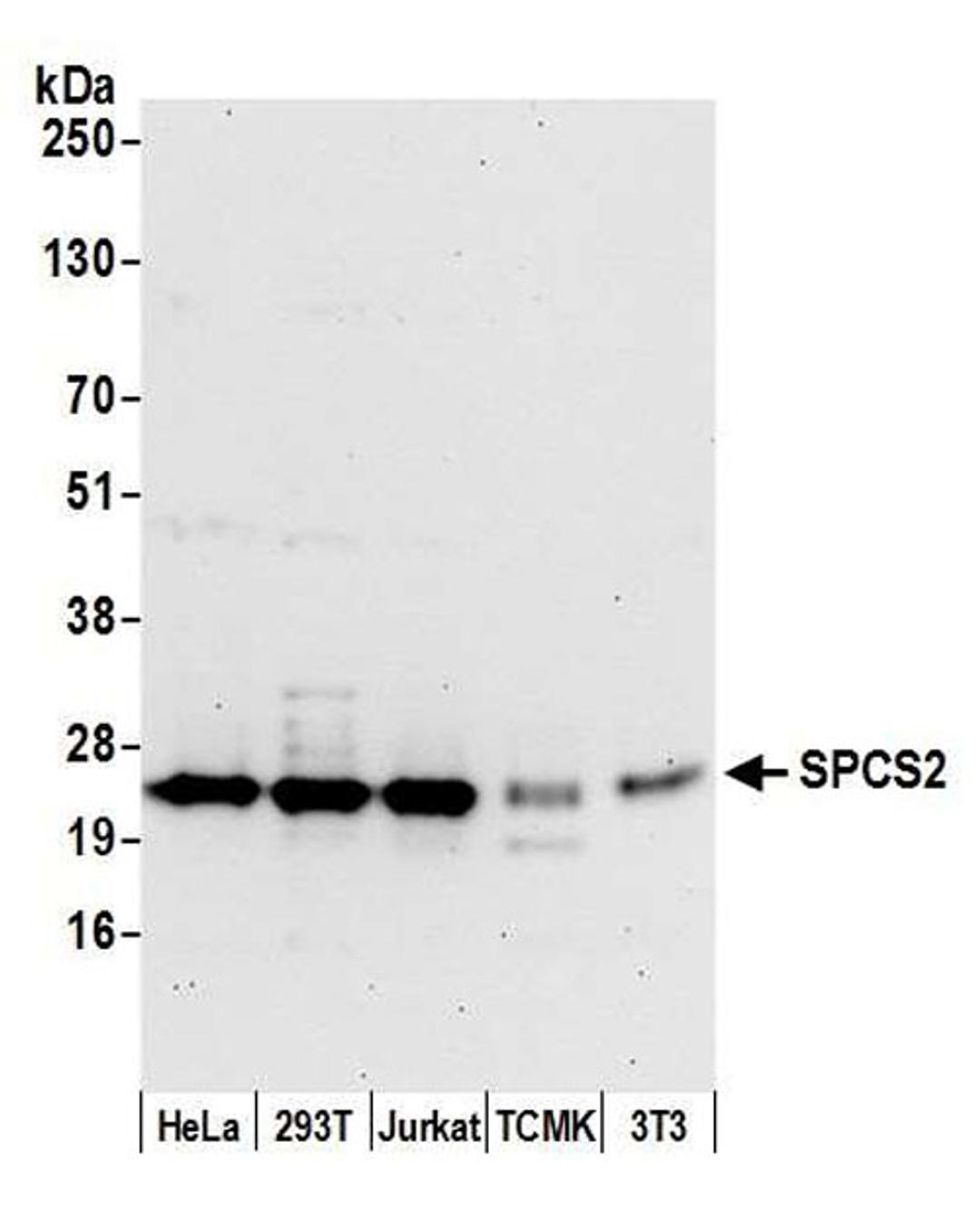 Detection of human and mouse SPCS2 by WB.