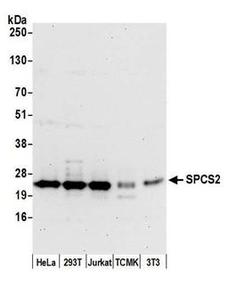 Detection of human and mouse SPCS2 by WB.