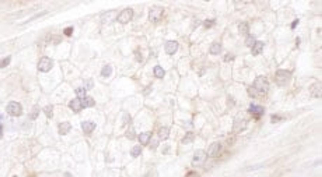 Detection of human Desmoplakin by immunohistochemistry.