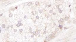 Detection of human Desmoplakin by immunohistochemistry.