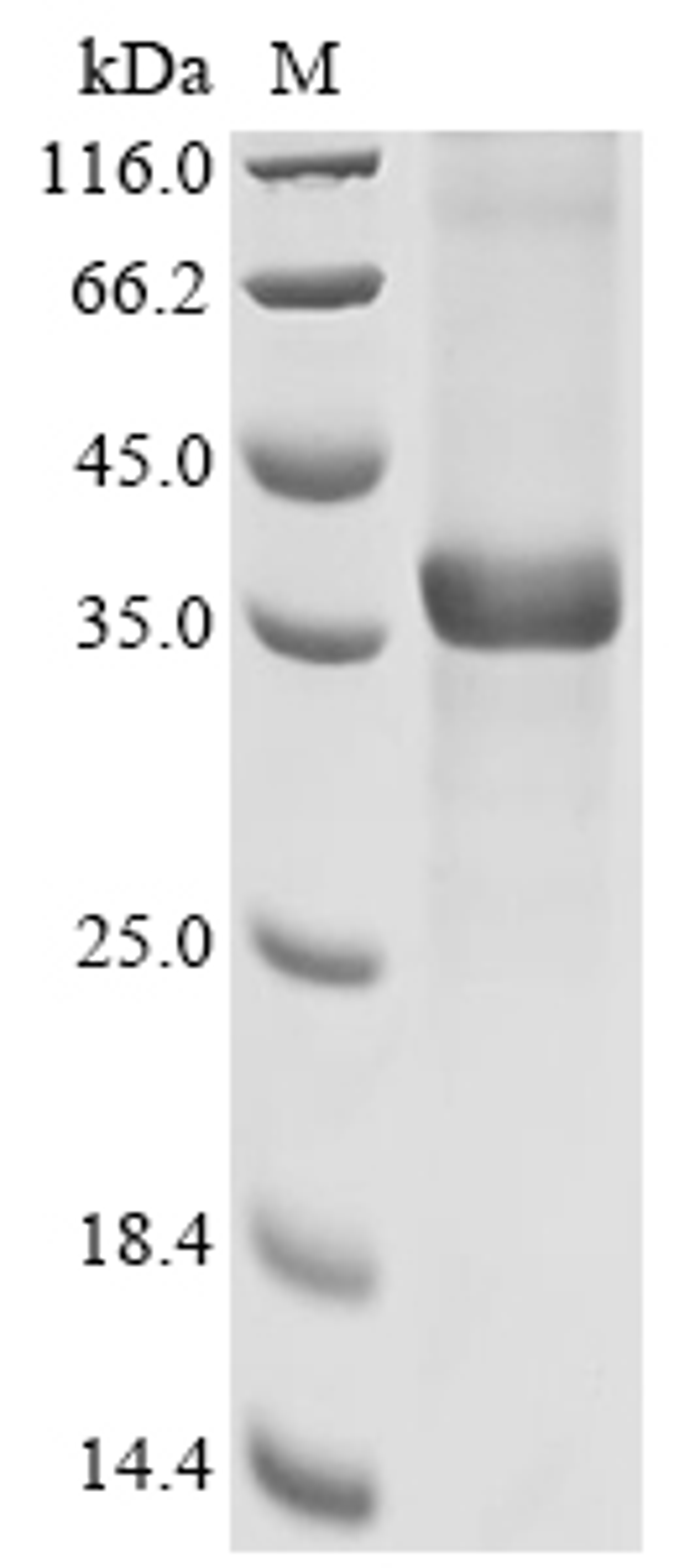 (Tris-Glycine gel) Discontinuous SDS-PAGE (reduced) with 5% enrichment gel and 15% separation gel.