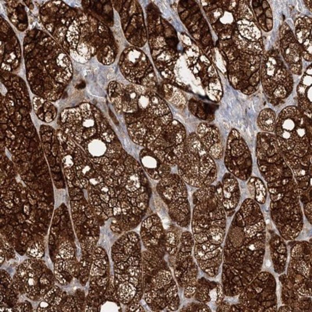 Immunohistochemistry-Paraffin: C2CD2 Antibody [NBP2-33941] - Immunohistochemical staining of human adrenal gland shows strong cytoplasmic and membranous positivity in glandular cells.