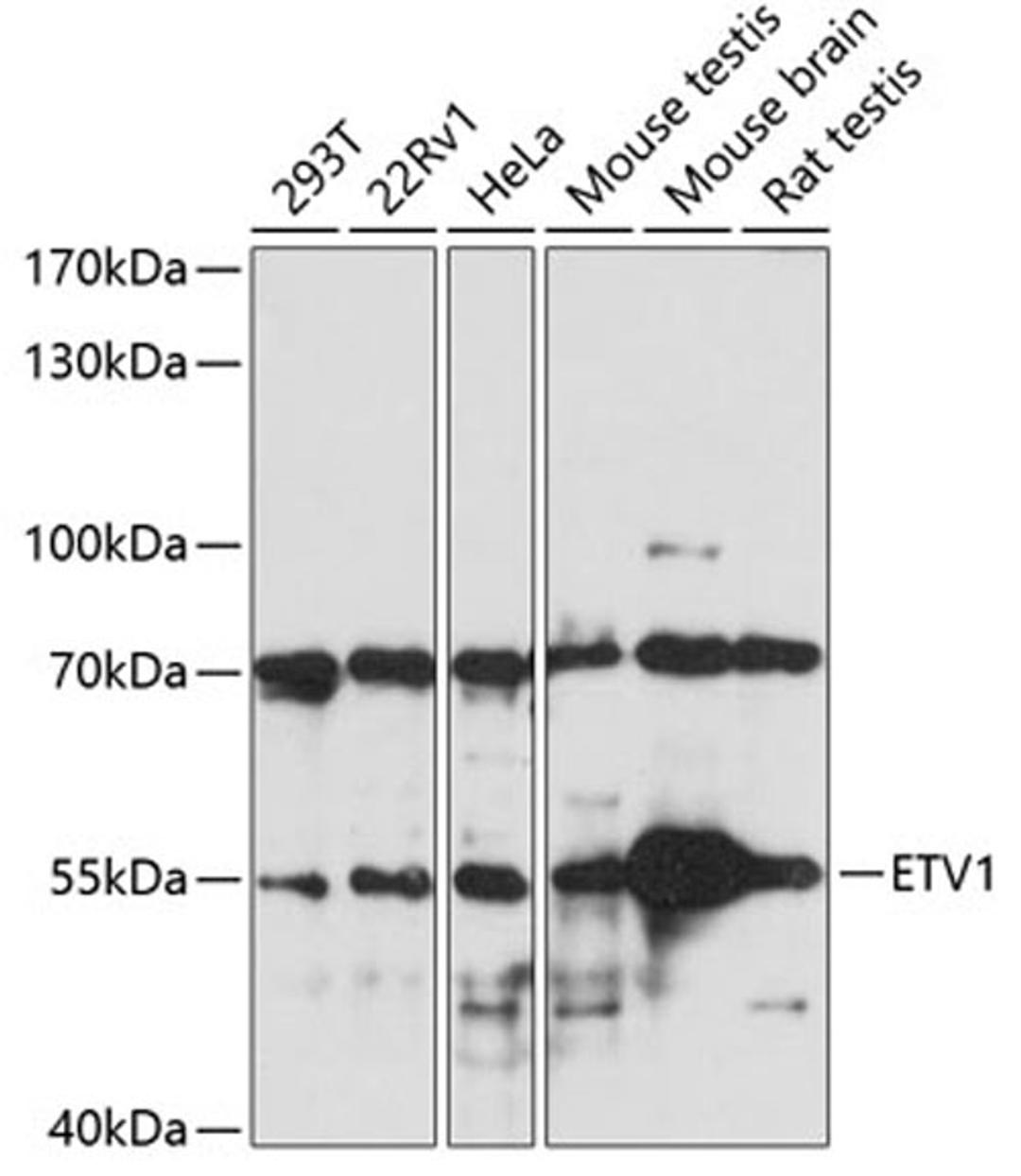 Western blot - ETV1 antibody (A7184)