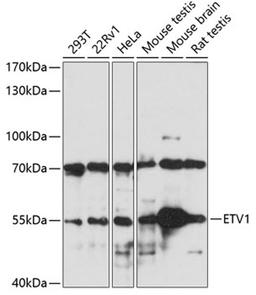 Western blot - ETV1 antibody (A7184)