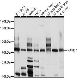 Western blot - PAPD7 antibody (A10017)