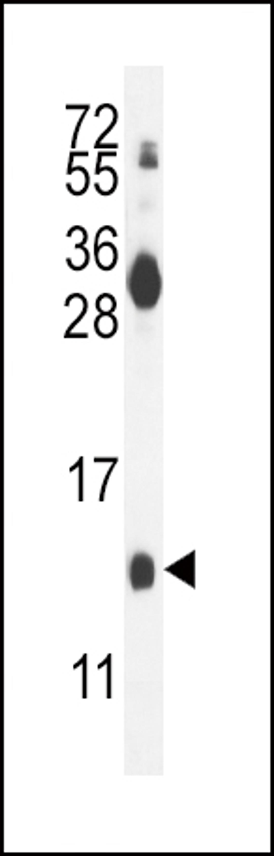 Western blot analysis in mouse kidney tissue lysates (35ug/lane).