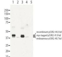 Western blot analysis of recombinant (lanes 1 and 3) and endogenous protein (lanes 1 to 4) in whole cell extracts from transfected 293T. Lane 1 contains purified recombinant human p53R2. Lane 2 contains 293T cells transfected with control vector. Lane 3 c