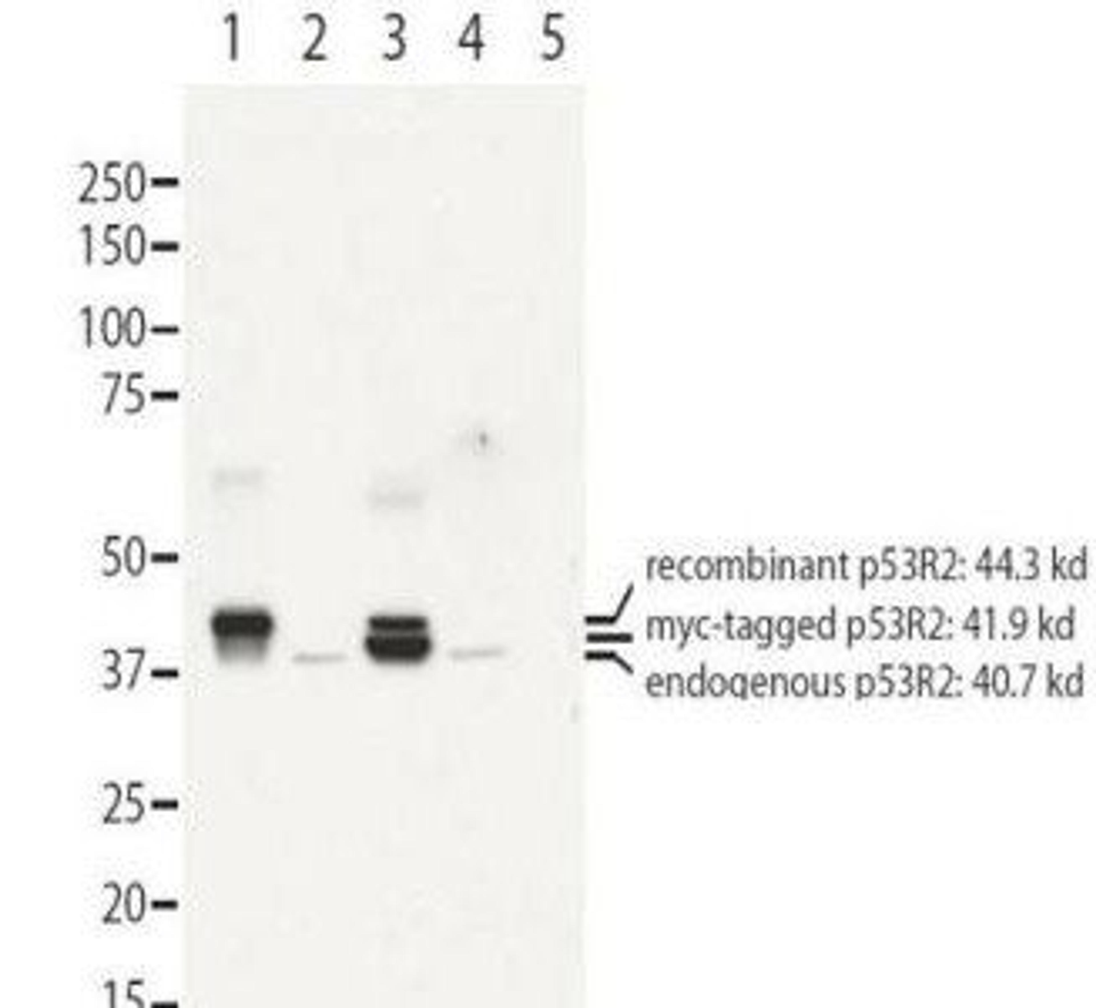 Western blot analysis of recombinant (lanes 1 and 3) and endogenous protein (lanes 1 to 4) in whole cell extracts from transfected 293T. Lane 1 contains purified recombinant human p53R2. Lane 2 contains 293T cells transfected with control vector. Lane 3 c