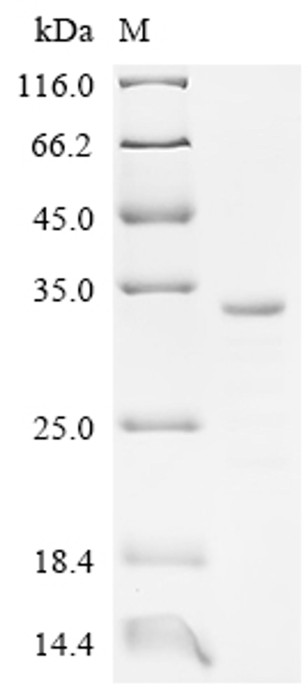 (Tris-Glycine gel) Discontinuous SDS-PAGE (reduced) with 5% enrichment gel and 15% separation gel.