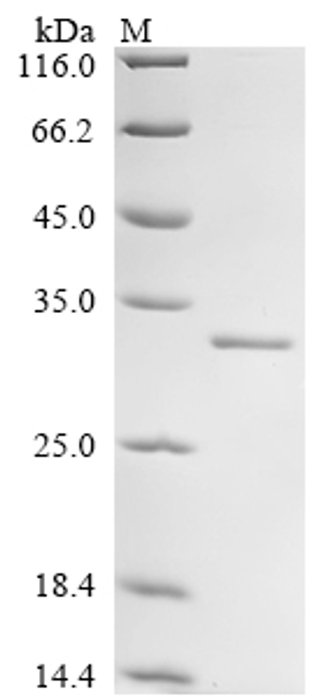 (Tris-Glycine gel) Discontinuous SDS-PAGE (reduced) with 5% enrichment gel and 15% separation gel.