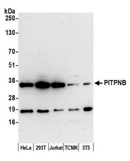 Detection of human and mouse PITPNB by WB.