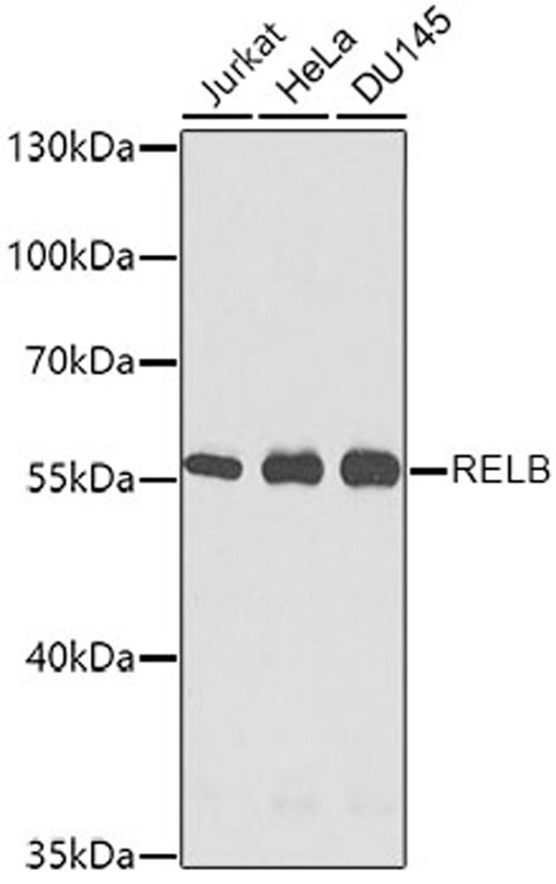 Western blot - RELB antibody (A0519)