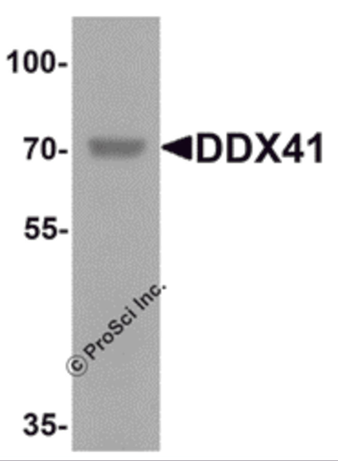 Western blot analysis of DDX41 in rat brain tissue lysate with DDX41 antibody at 1 μg/mL.