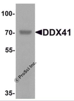 Western blot analysis of DDX41 in rat brain tissue lysate with DDX41 antibody at 1 μg/mL.