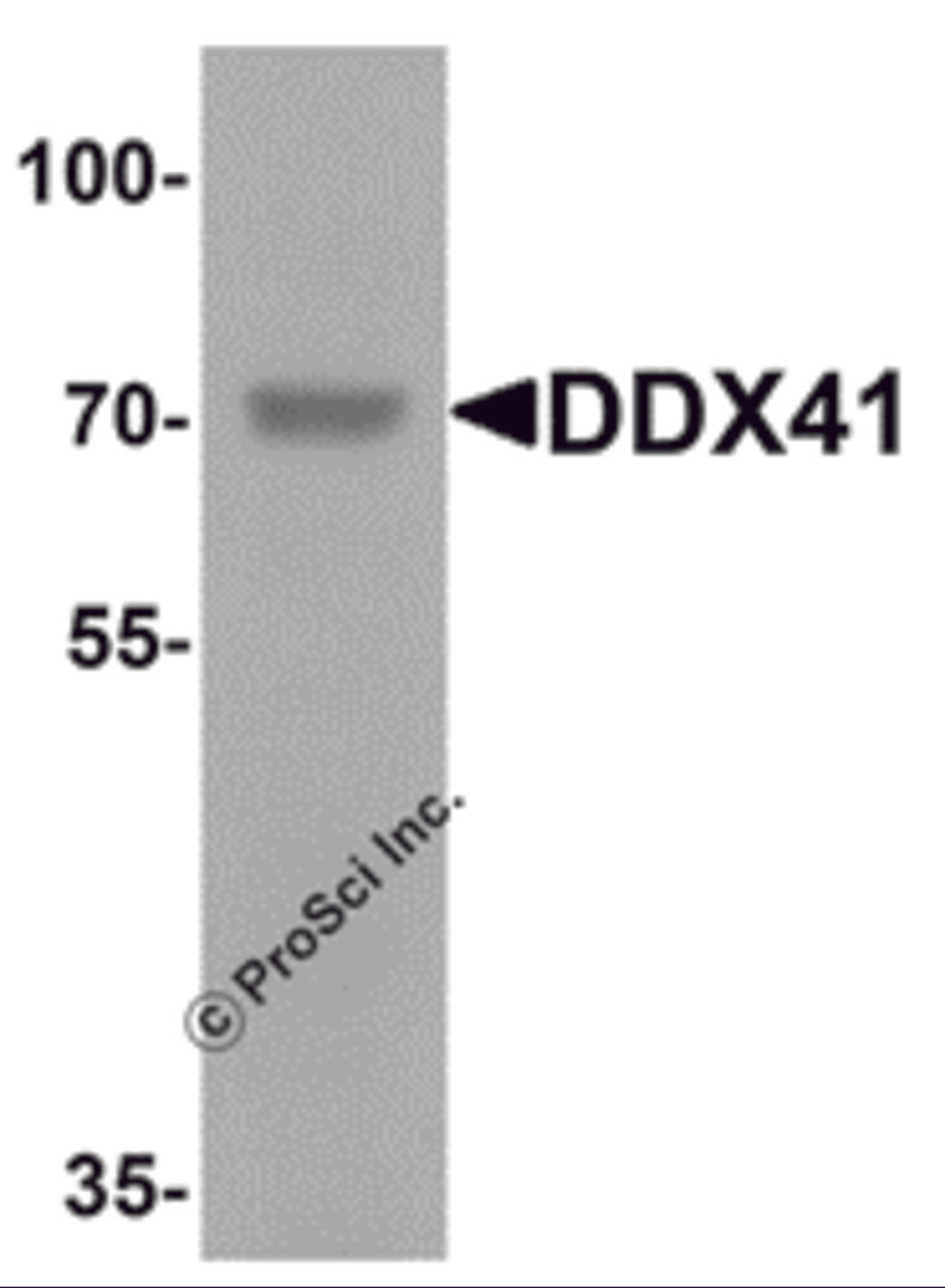 Western blot analysis of DDX41 in rat brain tissue lysate with DDX41 antibody at 1 μg/mL.