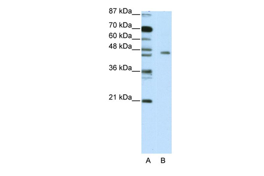 Antibody used in WB on Human Jurkat 5.0 ug/ml.