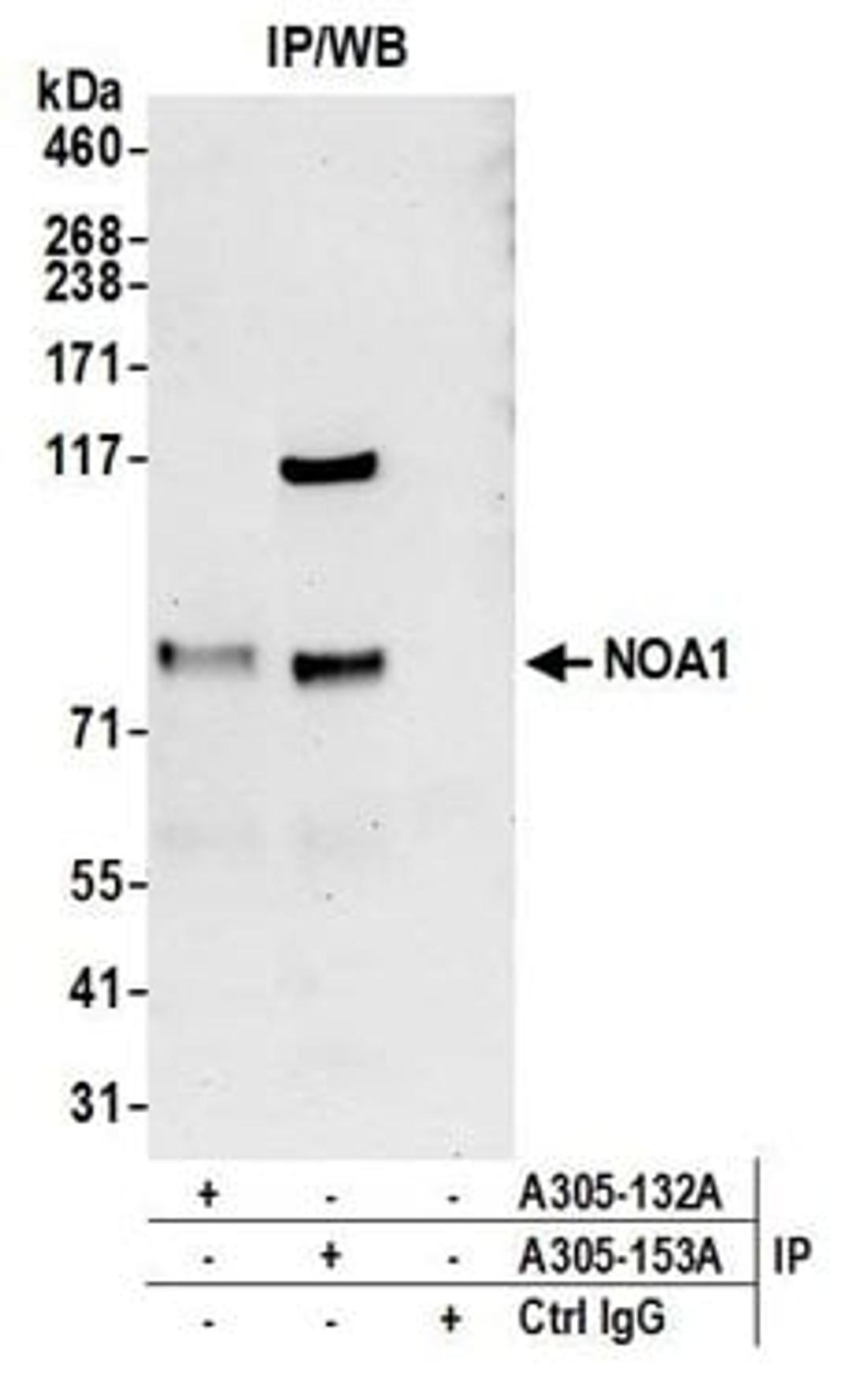 Detection of human NOA1 by western blot of immunoprecipitates.