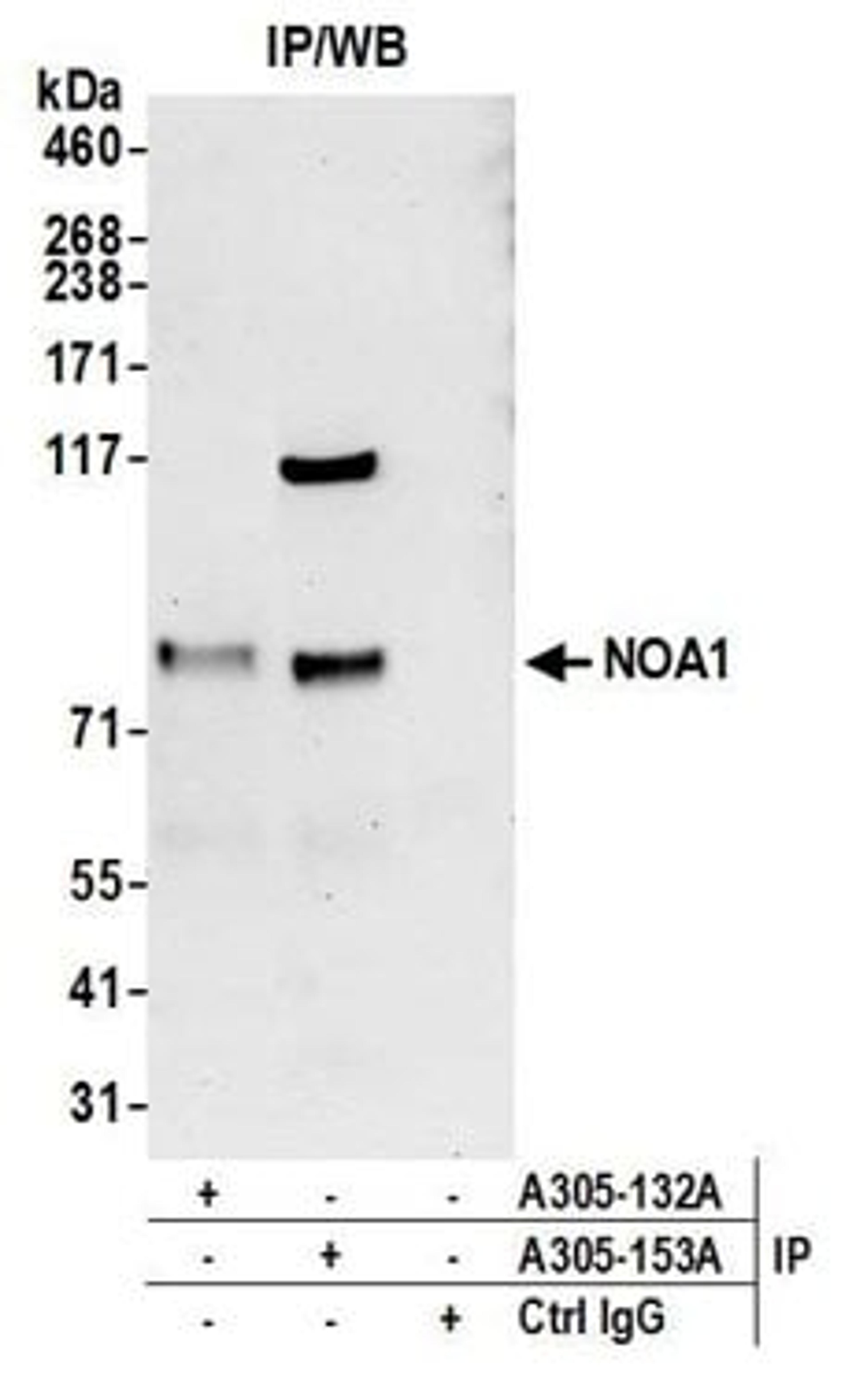 Detection of human NOA1 by western blot of immunoprecipitates.