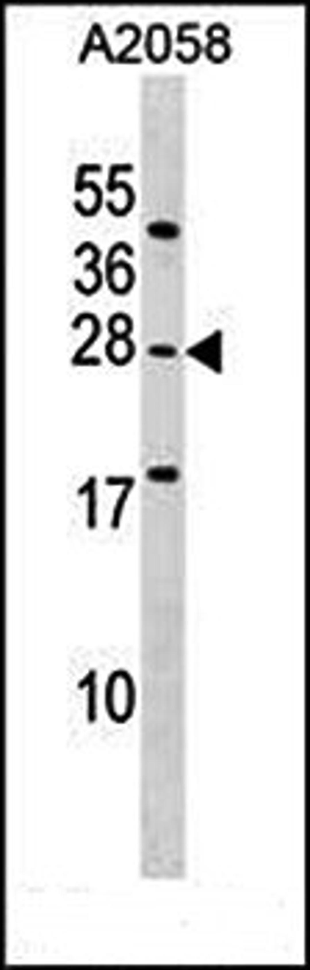 Western blot analysis of A2058 cell line lysates (35ug/lane) using EPDR1 (Center) antibody