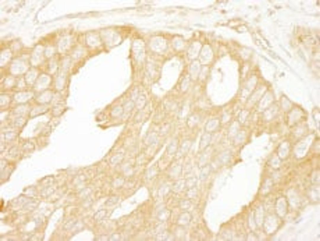 Detection of human BRAF by immunohistochemistry.