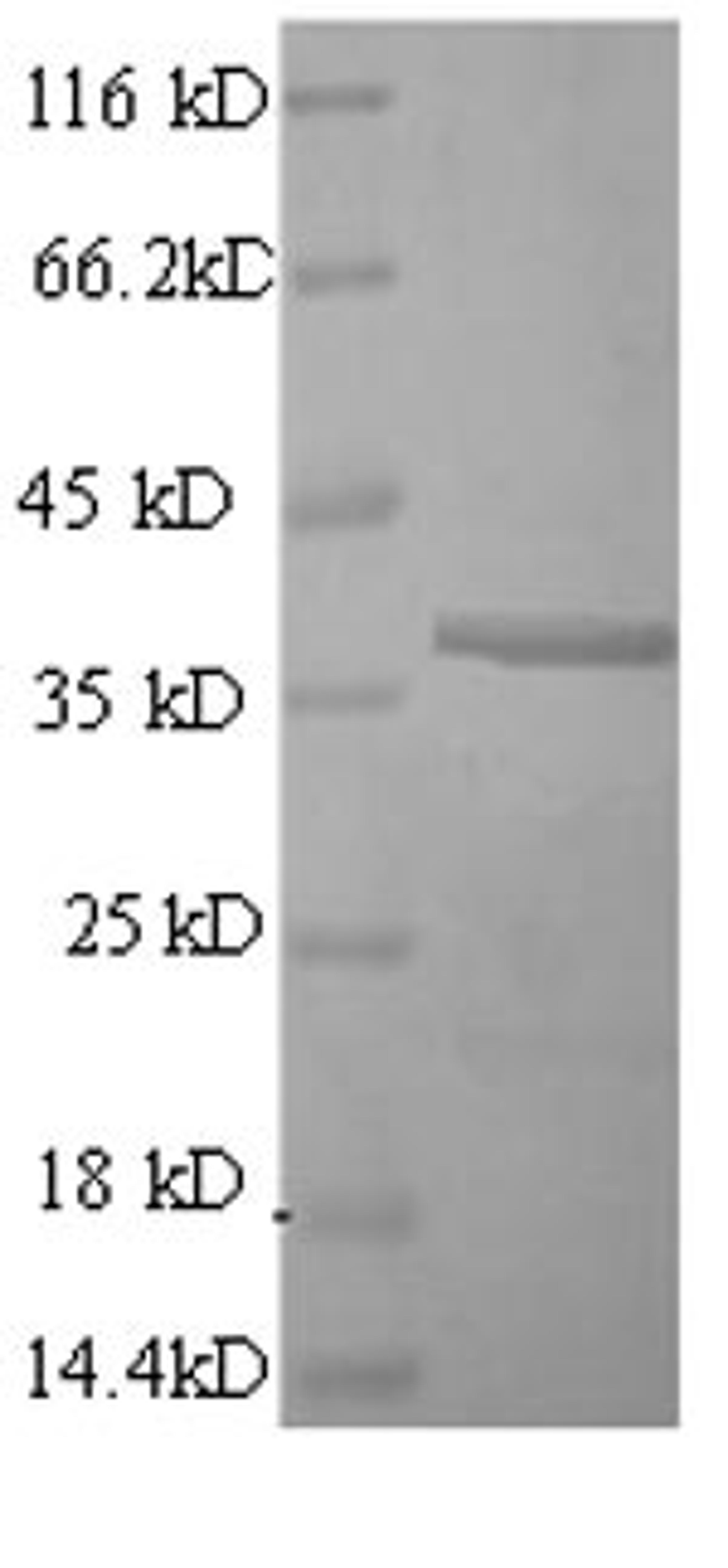 (Tris-Glycine gel) Discontinuous SDS-PAGE (reduced) with 5% enrichment gel and 15% separation gel.