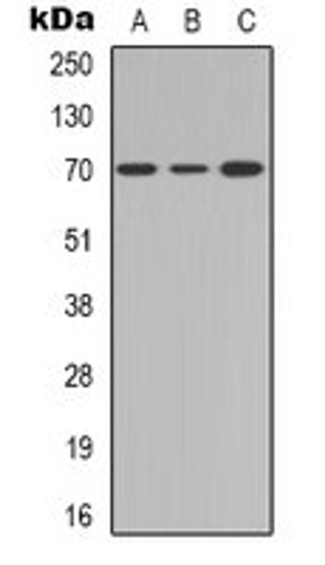 Western blot analysis of Jurkat (Lane 1), mouse brain (Lane 2), PC12 (Lane 3) whole cell lysates using CD122 antibody