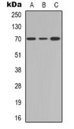 Western blot analysis of Jurkat (Lane 1), mouse brain (Lane 2), PC12 (Lane 3) whole cell lysates using CD122 antibody