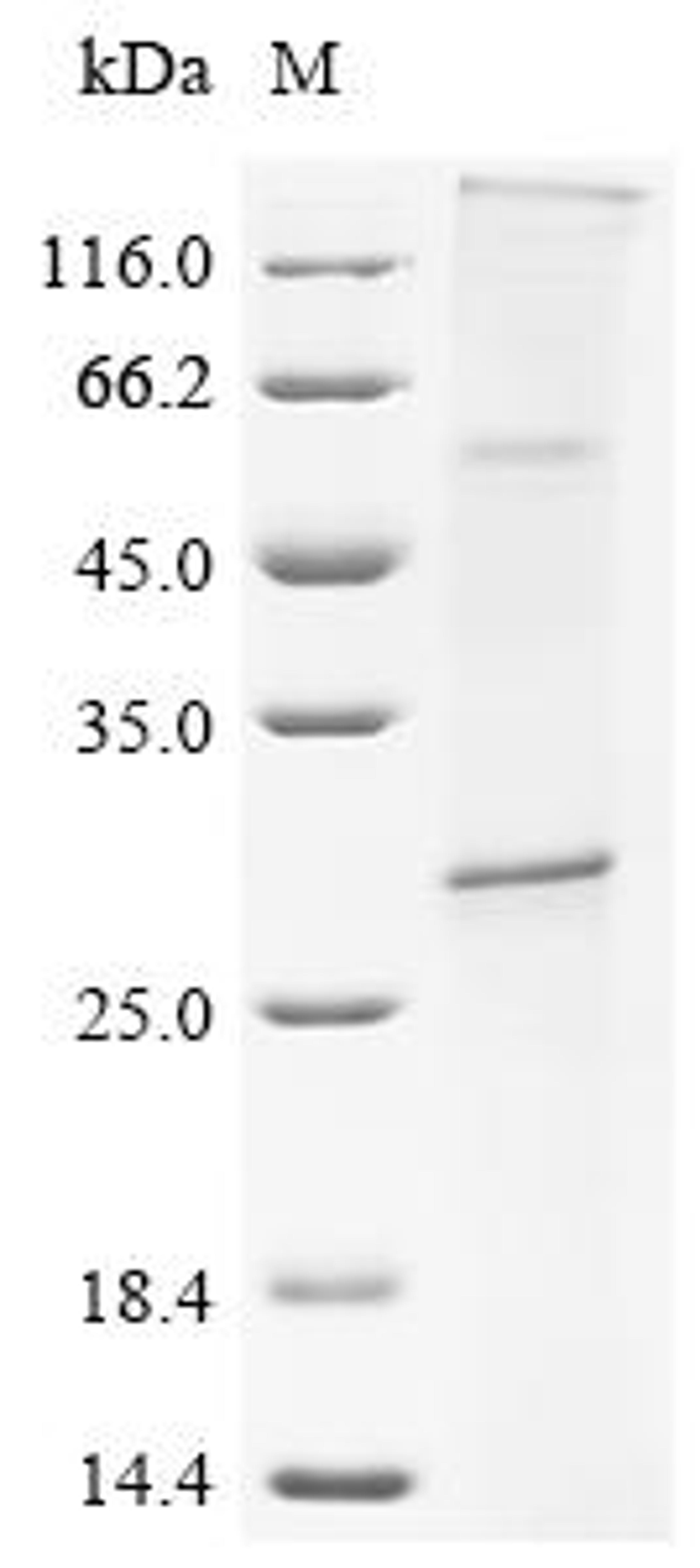 (Tris-Glycine gel) Discontinuous SDS-PAGE (reduced) with 5% enrichment gel and 15% separation gel.