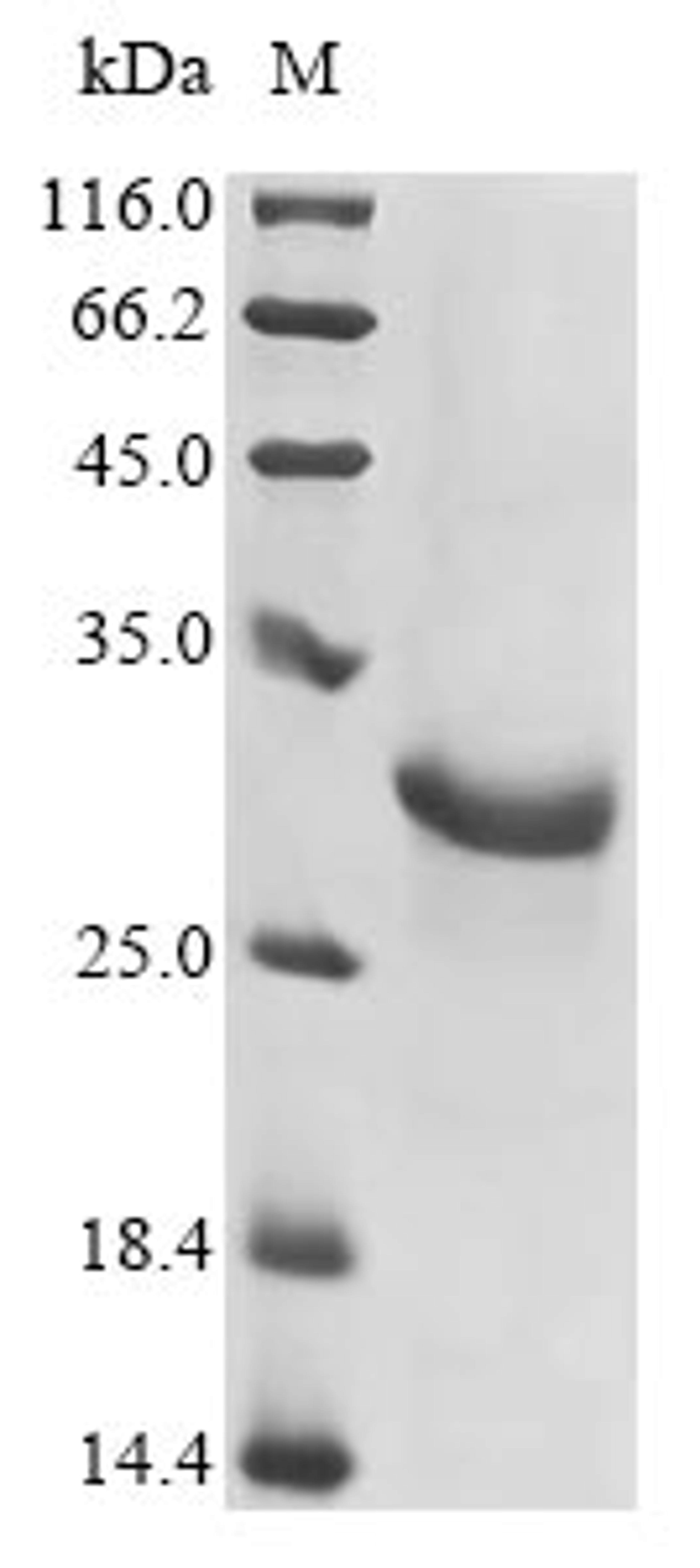 (Tris-Glycine gel) Discontinuous SDS-PAGE (reduced) with 5% enrichment gel and 15% separation gel.