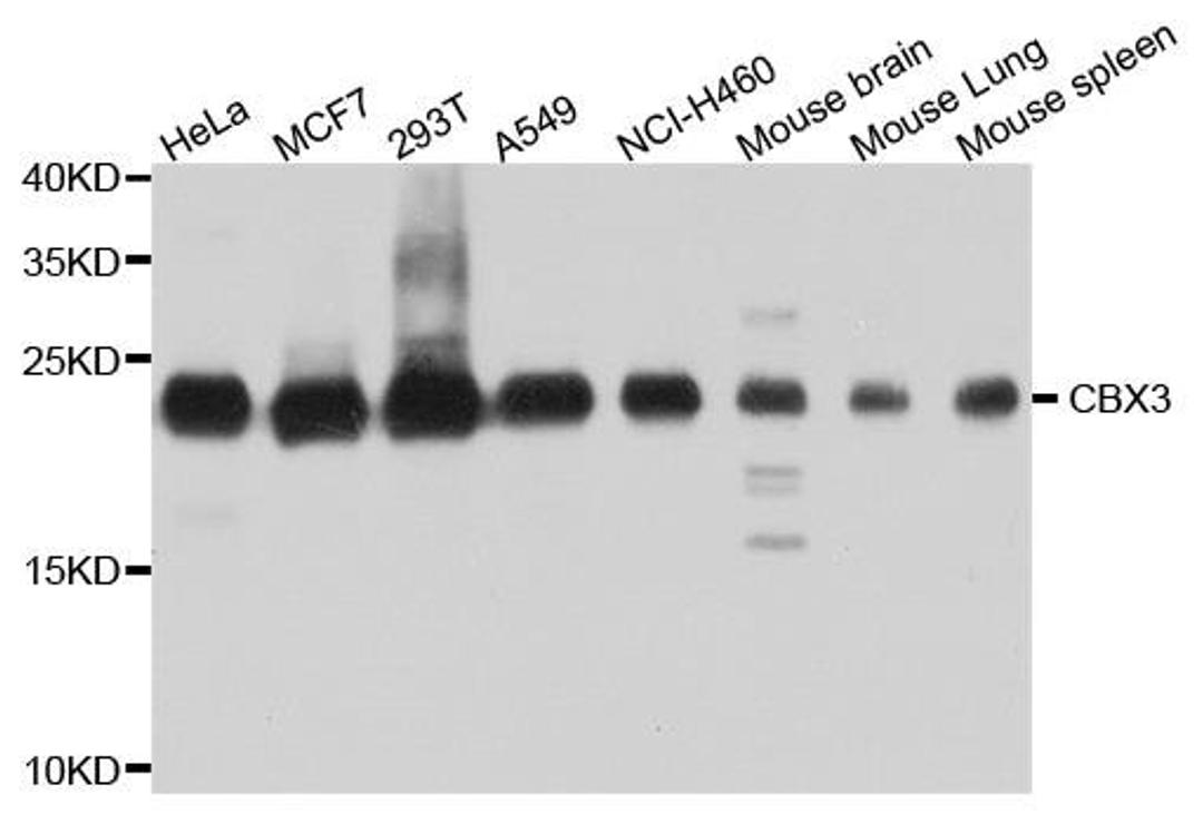 Western blot analysis of extract of various cells using HP1 gamma antibody