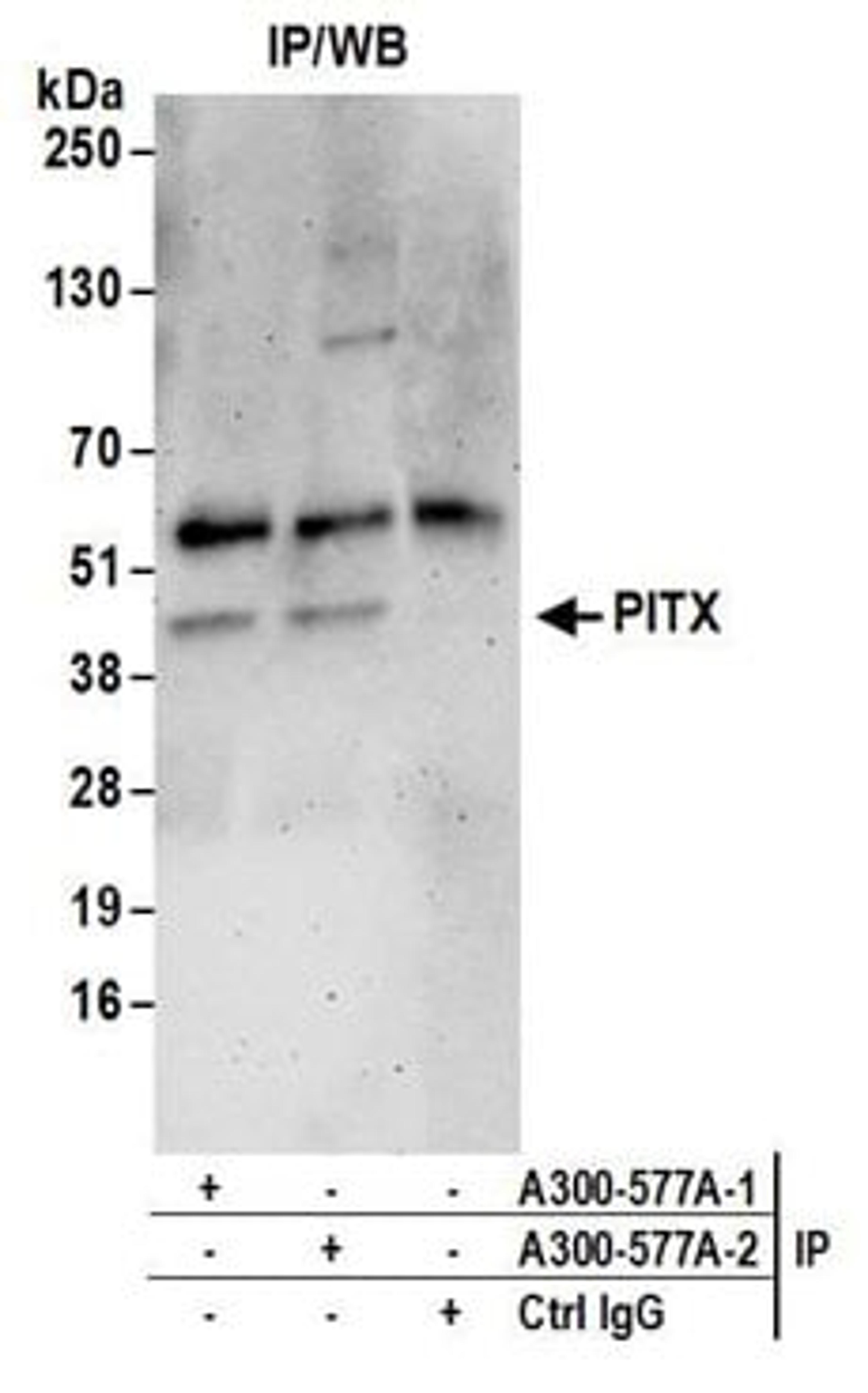 Detection of human PITX by western blot of immunoprecipitates.