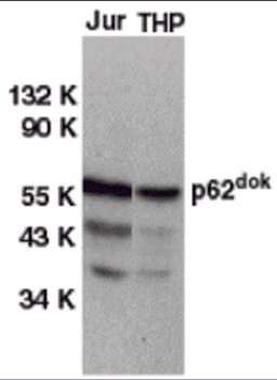 Western blot analysis of DOK1 in Jurkat (Jur) and THP-1 (THP) cell lysates with DOK1 antibody at 1 μg/mL.