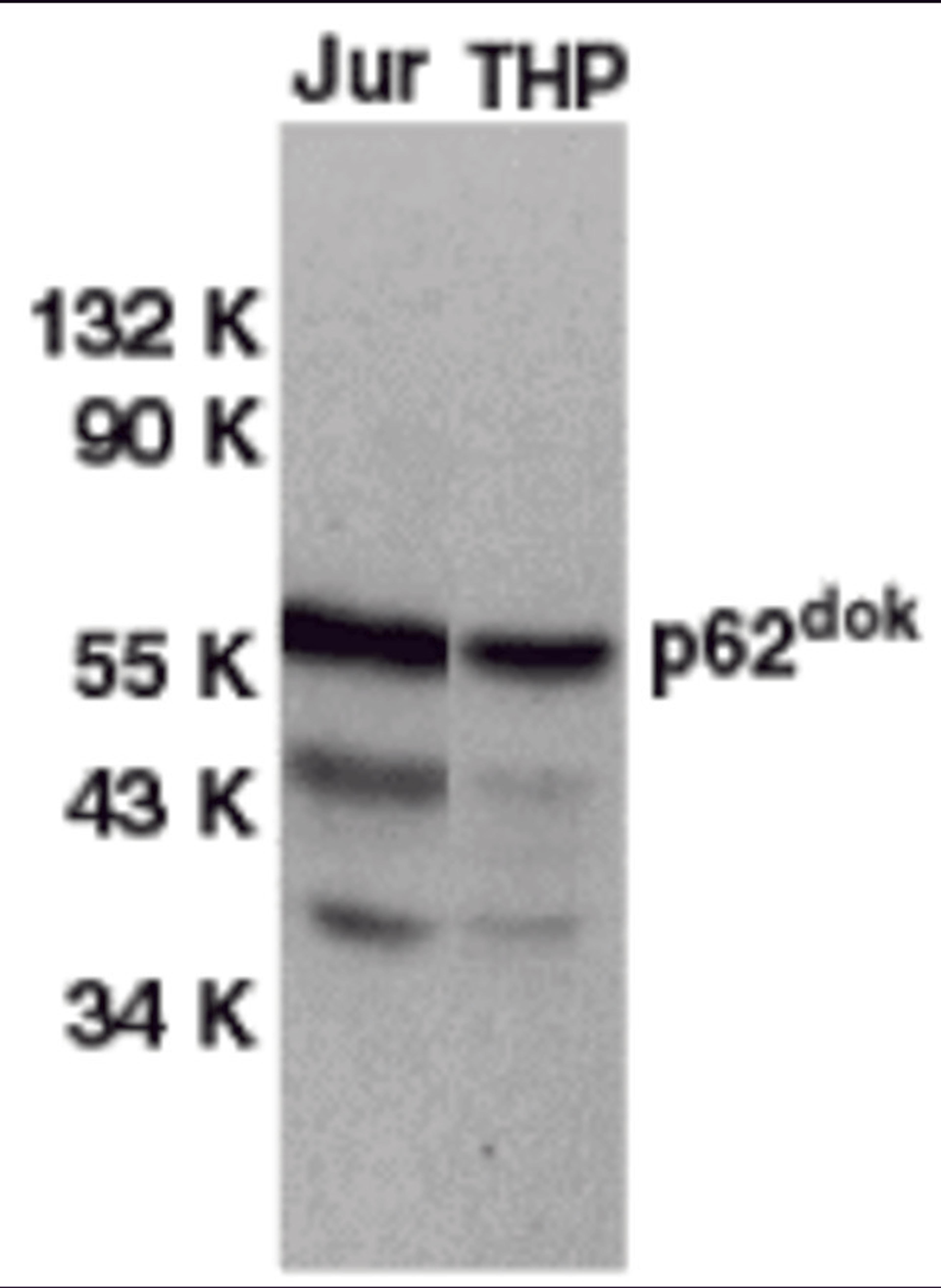Western blot analysis of DOK1 in Jurkat (Jur) and THP-1 (THP) cell lysates with DOK1 antibody at 1 μg/mL.
