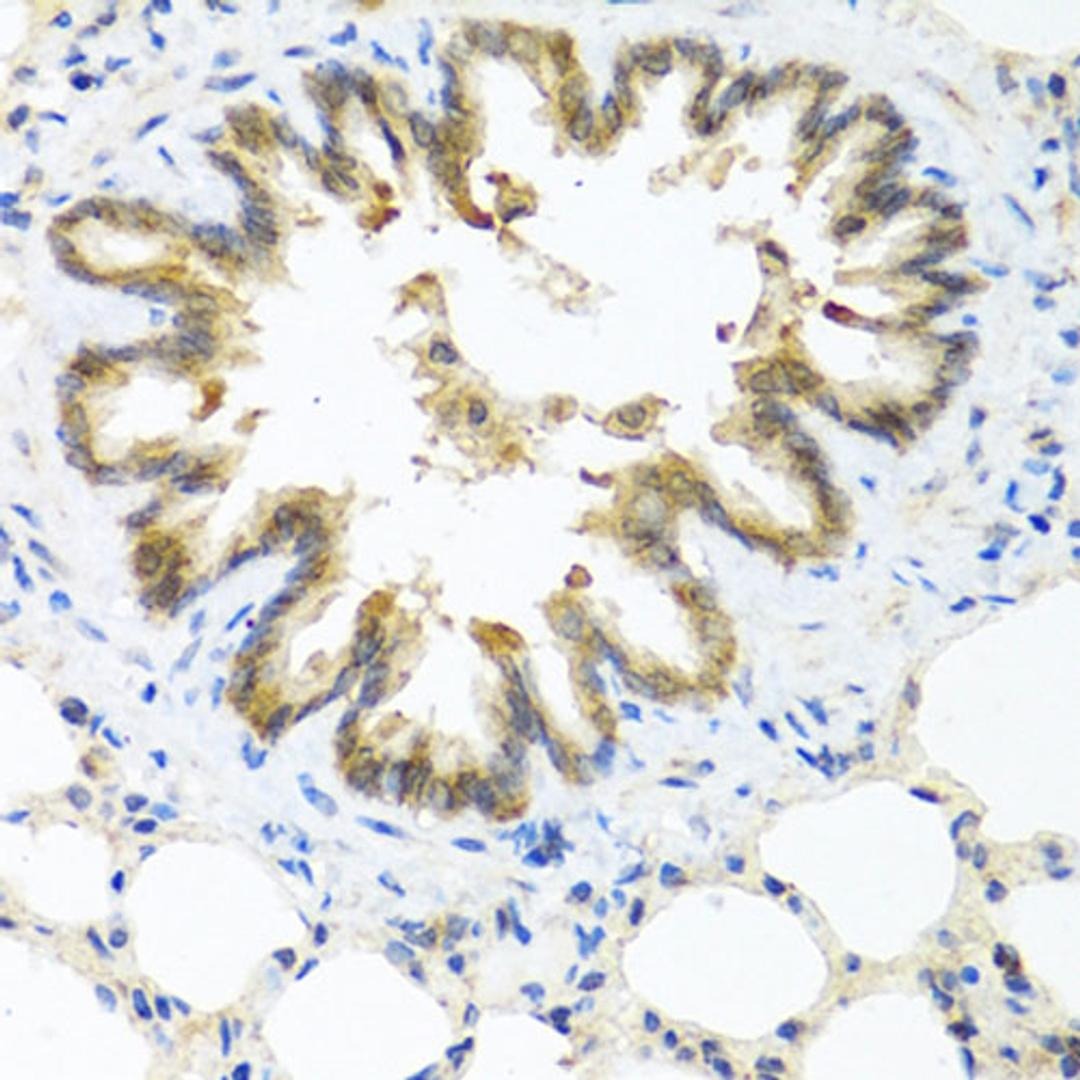 Immunohistochemistry  - S100A7 antibody (A1940)