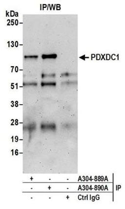 Detection of human PDXDC1 by western blot of immunoprecipitates.