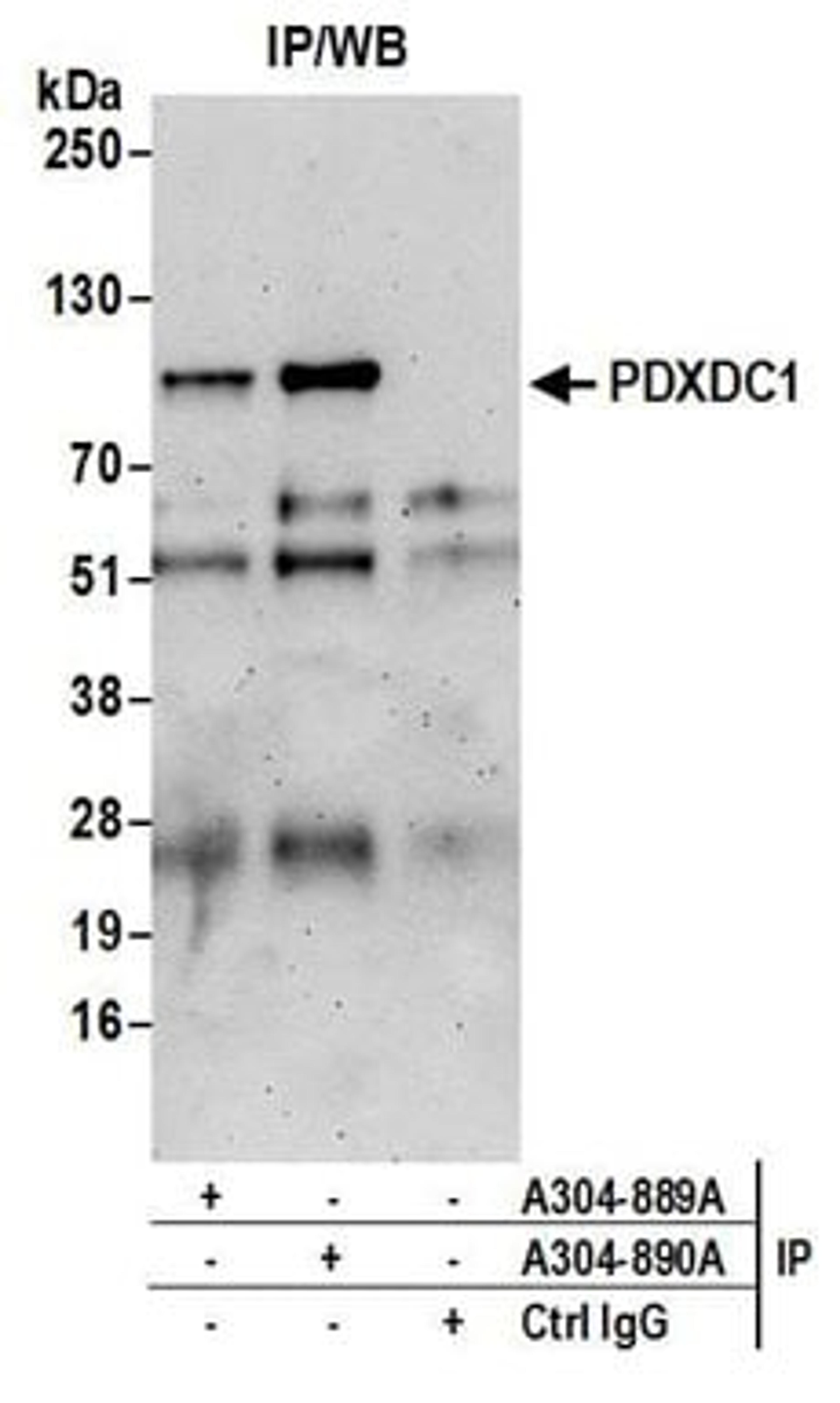 Detection of human PDXDC1 by western blot of immunoprecipitates.