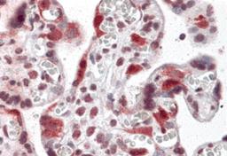 Immunohistochemistry of LZTS2 in human placenta tissue with LZTS2 antibody at 5 μg/mL.