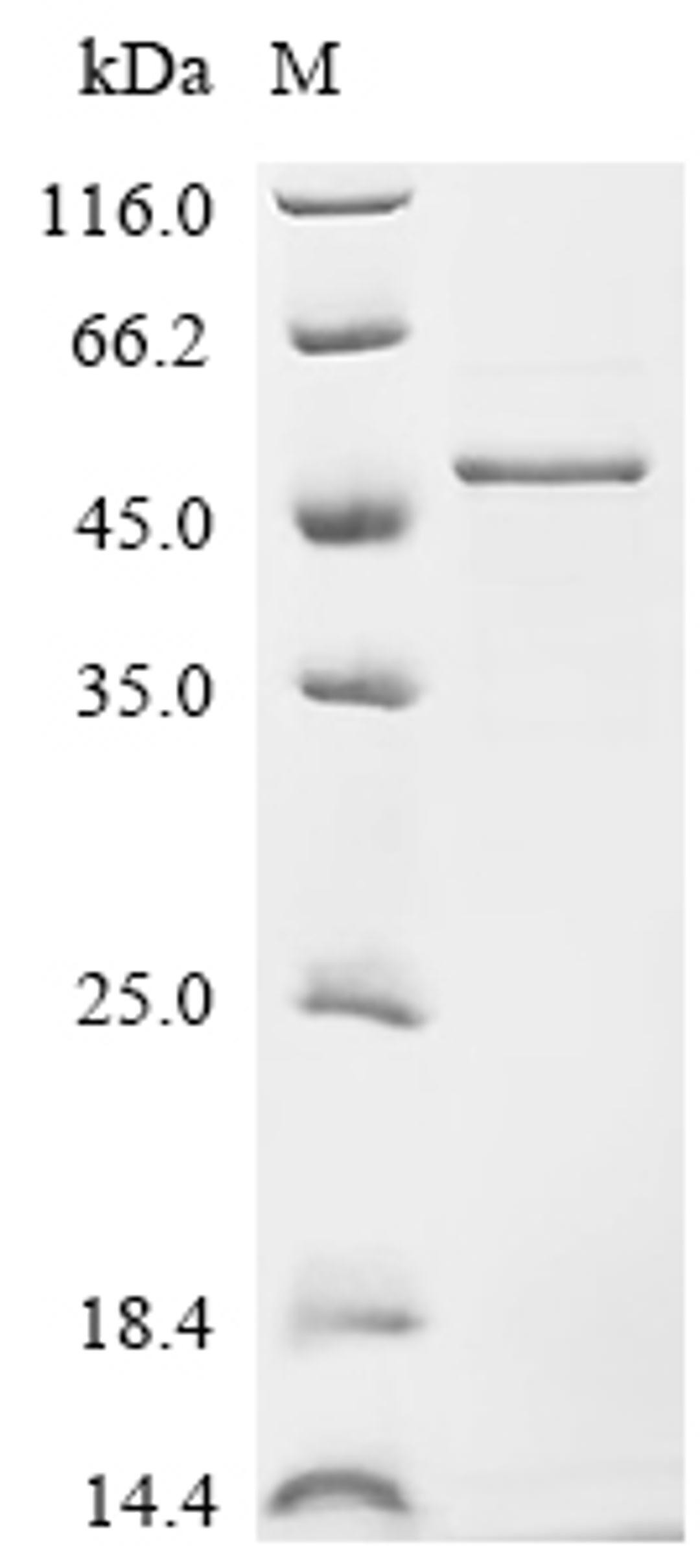(Tris-Glycine gel) Discontinuous SDS-PAGE (reduced) with 5% enrichment gel and 15% separation gel.