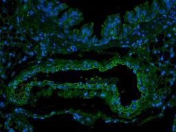 Immunofluorescence image of rat lung tissue using EpCAM antibody (FITC) (5 ug/ml)