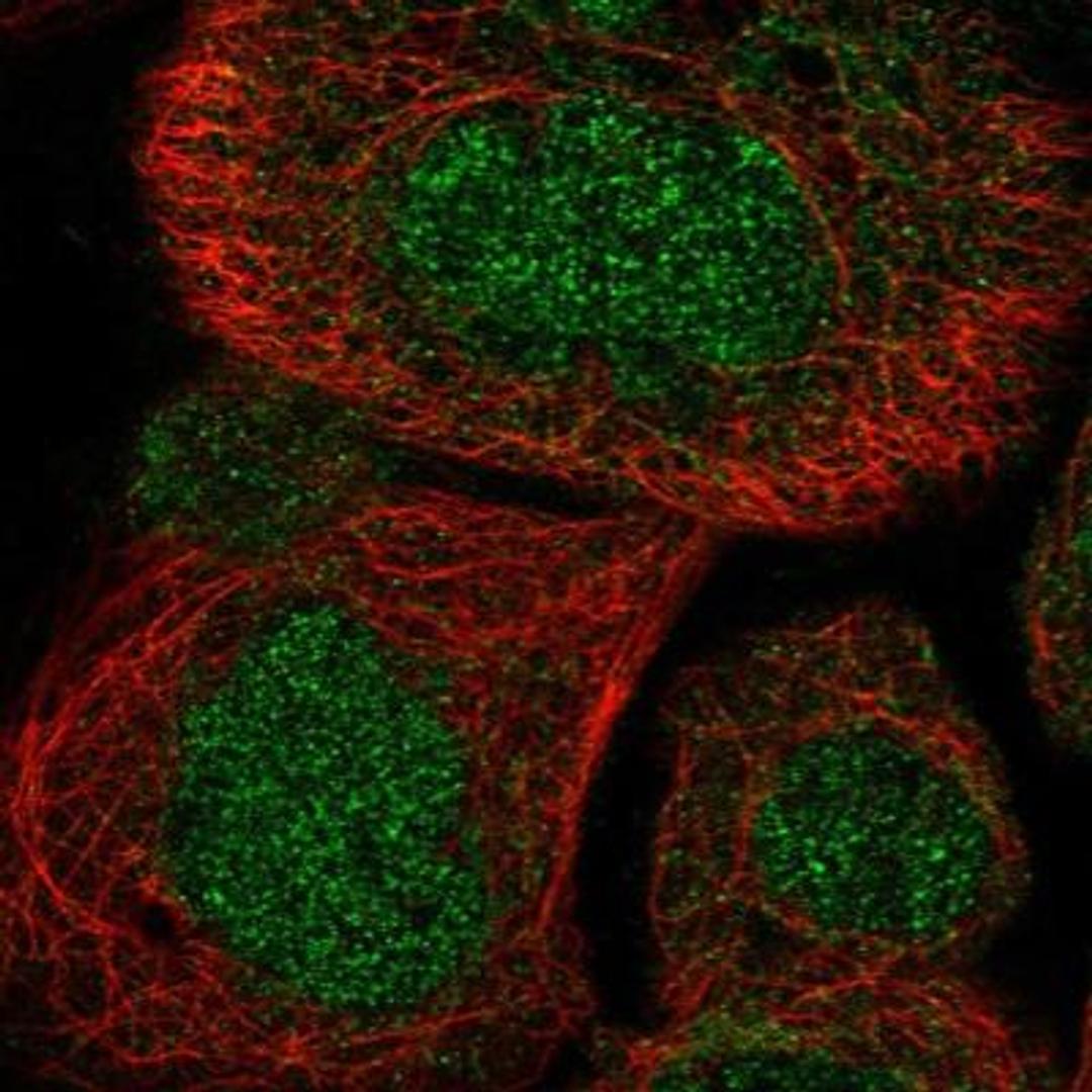 Immunocytochemistry/Immunofluorescence: EOMES Antibody [NBP1-80699] - Staining of human cell line A-431 shows positivity in nucleus.