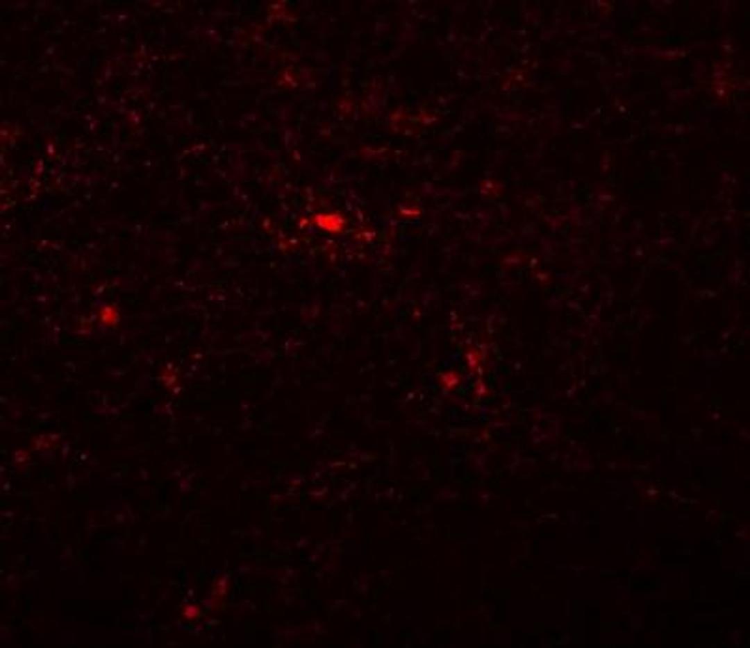 Immunocytochemistry/Immunofluorescence: NAT11 Antibody [NBP1-77095] - Immunofluorescence of NAT11 in mouse thymus tissue with NAT11 antibody at 20 ug/mL.