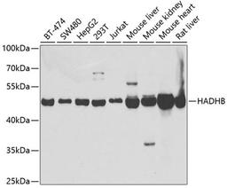 Western blot - HADHB antibody (A5716)