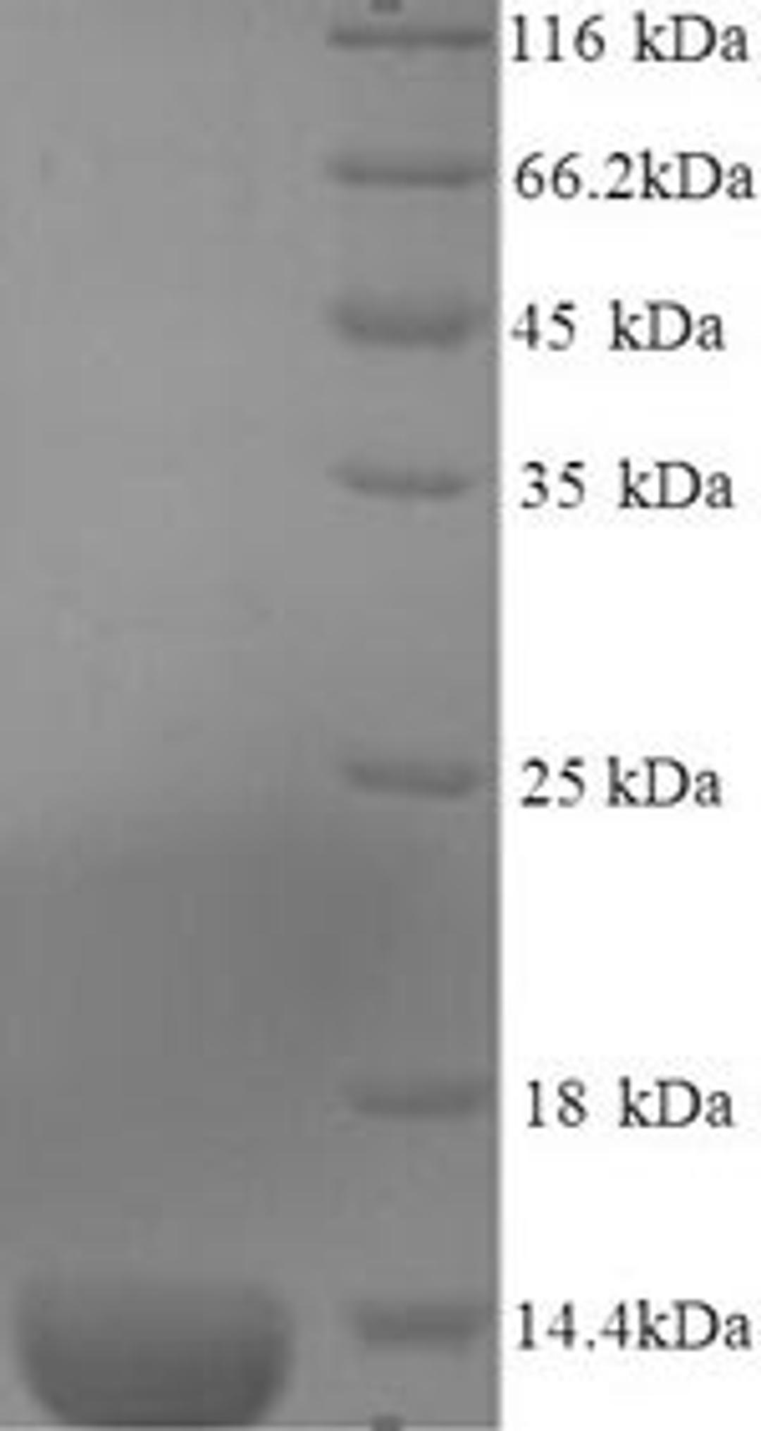(Tris-Glycine gel) Discontinuous SDS-PAGE (reduced) with 5% enrichment gel and 15% separation gel.