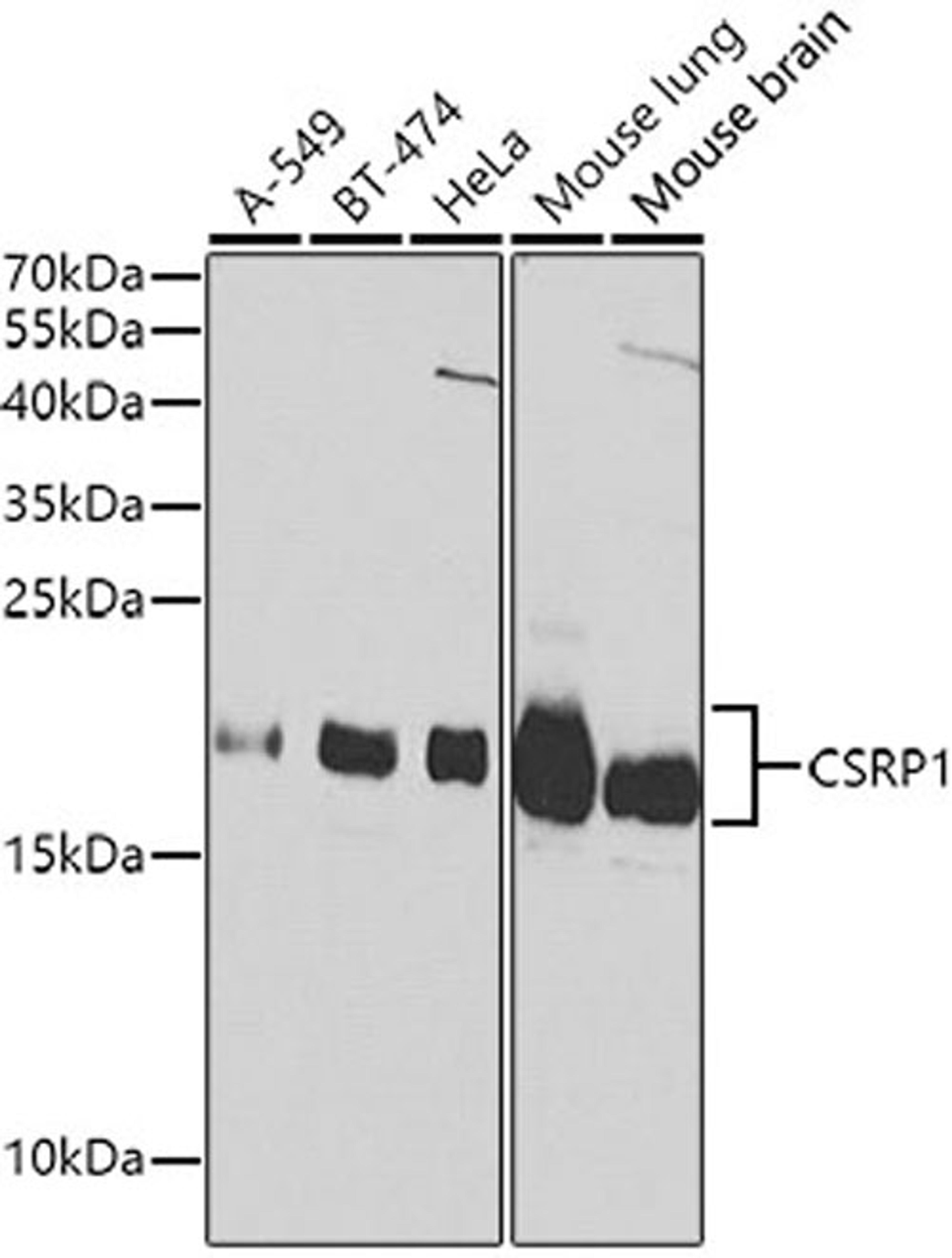 Western blot - CSRP1 Antibody (A1071)