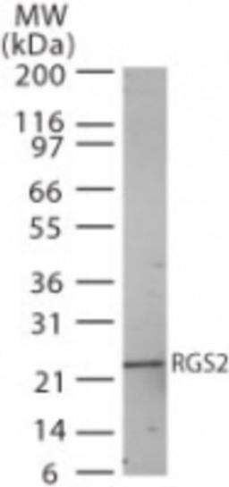 Western Blot: RGS2 Antibody [NB100-56736] - Western bot analysis of RGS2 in human heart lysate using RGS2 antibody at 2 ug/ml.