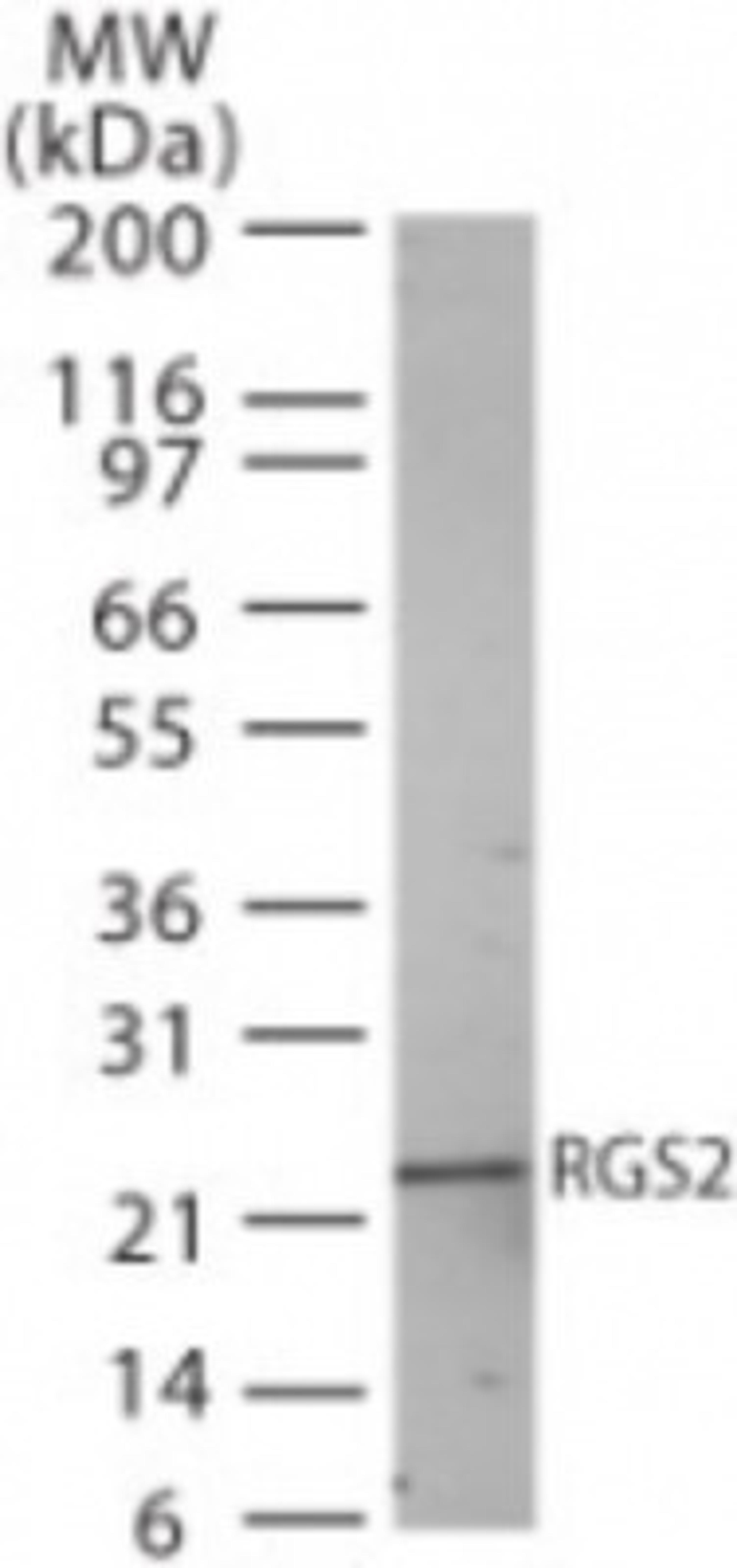 Western Blot: RGS2 Antibody [NB100-56736] - Western bot analysis of RGS2 in human heart lysate using RGS2 antibody at 2 ug/ml.