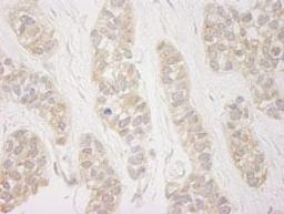 Detection of human DDX19 by immunohistochemistry.