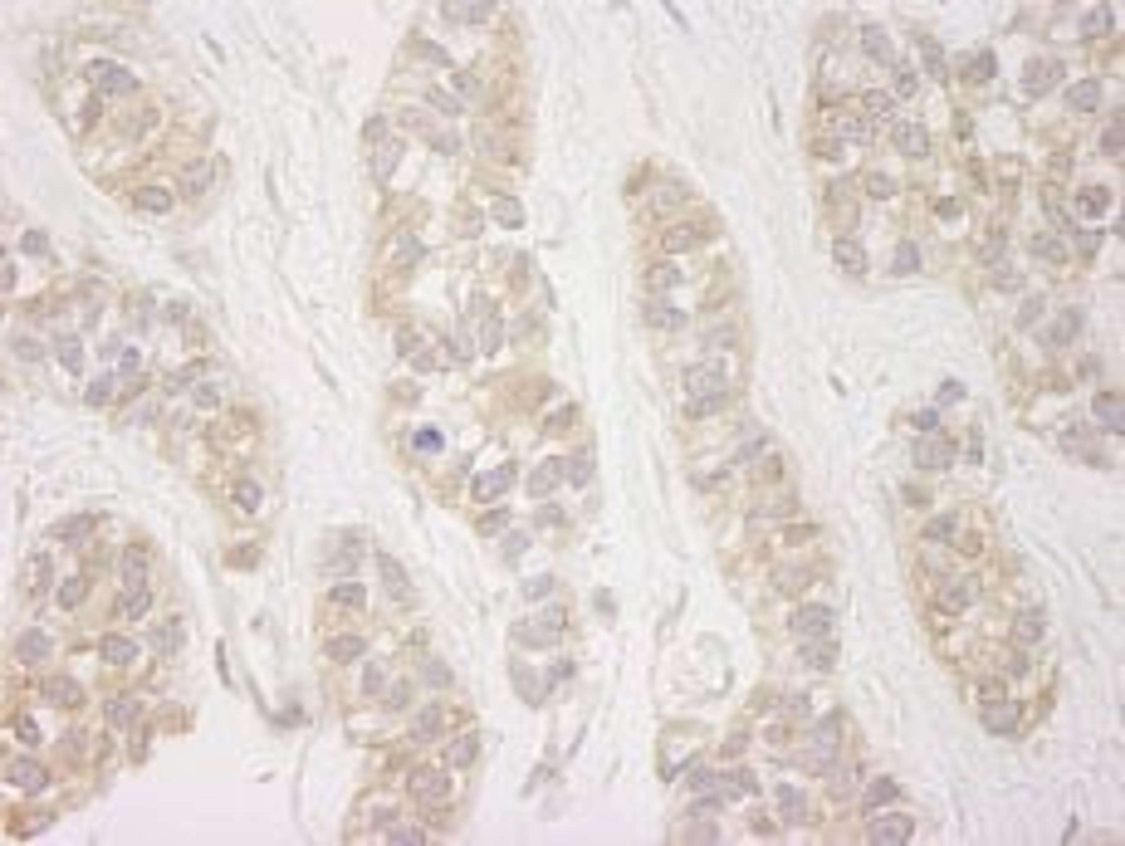 Detection of human DDX19 by immunohistochemistry.